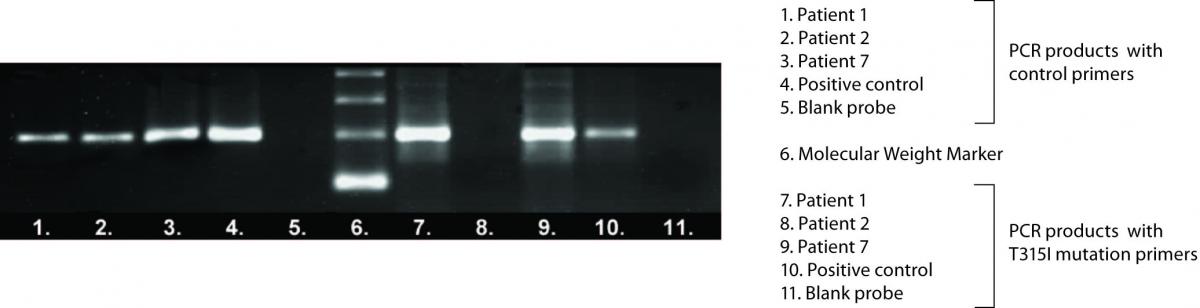 Horvat_I._T315I_mutation_Fig._1