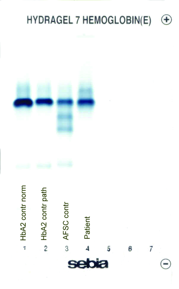 21-3_Zur_B._et_al._Figure_D2