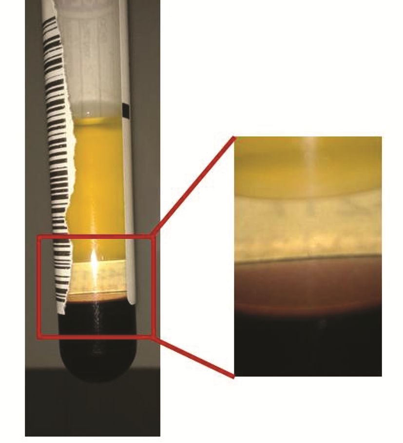 https://www.biochemia-medica.com/assets/images/upload/xml_tif/bm-26-248-f1.png