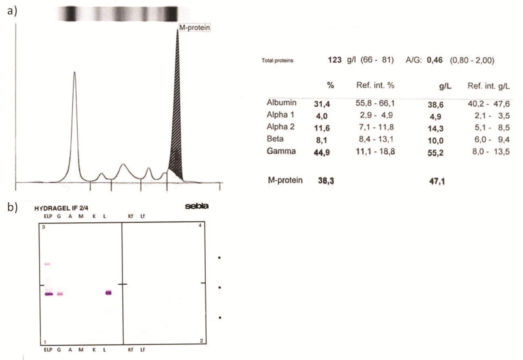 https://www.biochemia-medica.com/assets/images/upload/xml_tif/bm-26-248-f2.png
