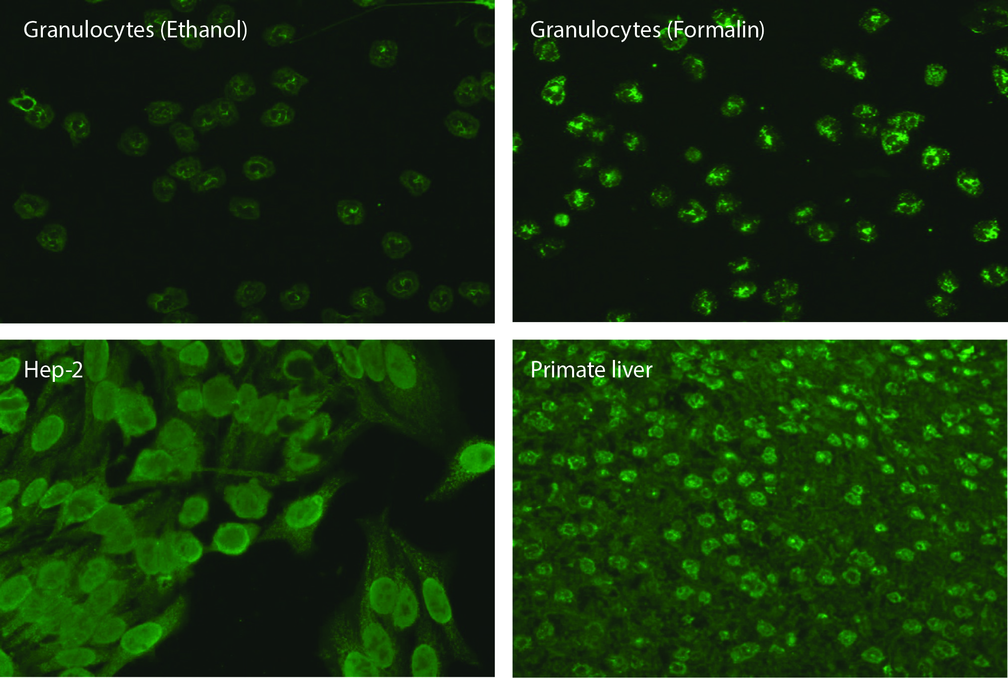 https://www.biochemia-medica.com/assets/images/upload/xml_tif/bm-33-3-031001-f1.png