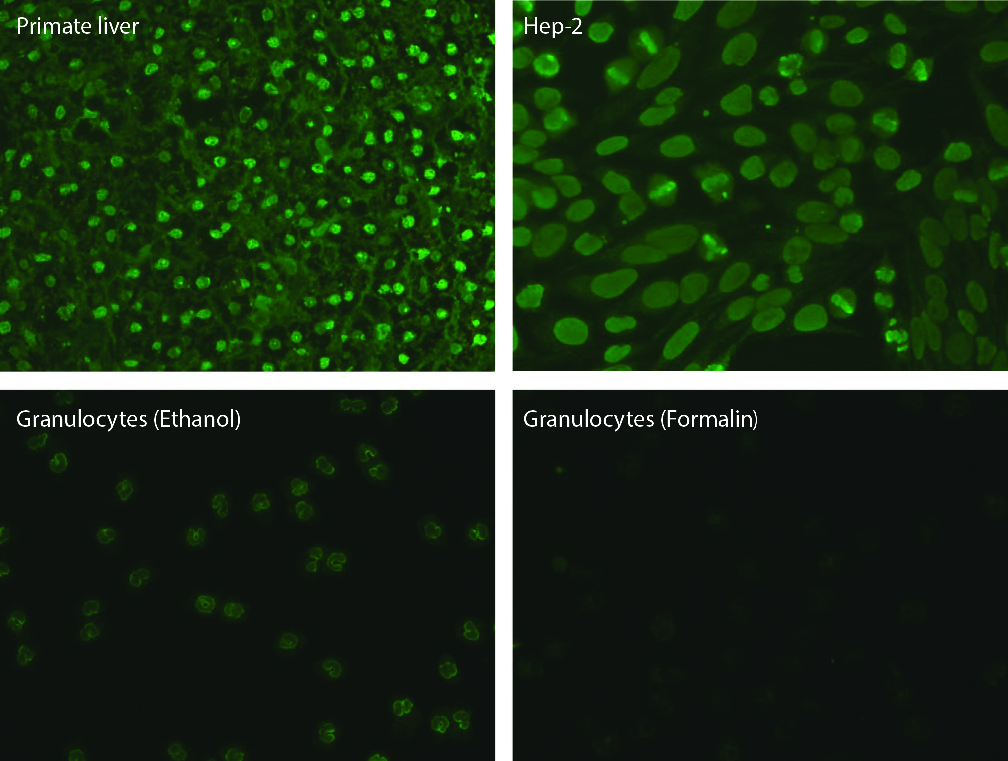 https://www.biochemia-medica.com/assets/images/upload/xml_tif/bm-33-3-031001-f2.png
