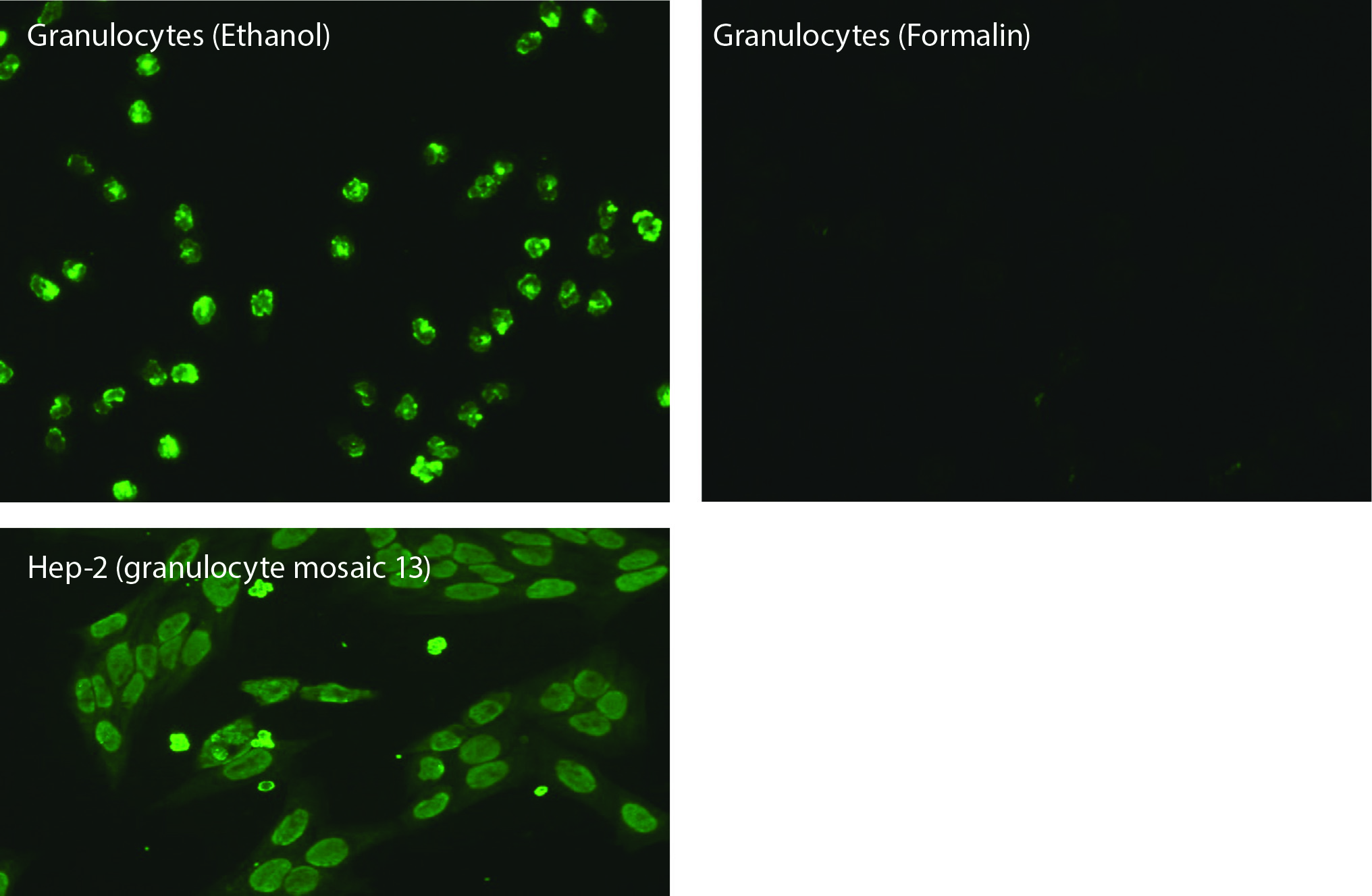 https://www.biochemia-medica.com/assets/images/upload/xml_tif/bm-33-3-031001-f3.png