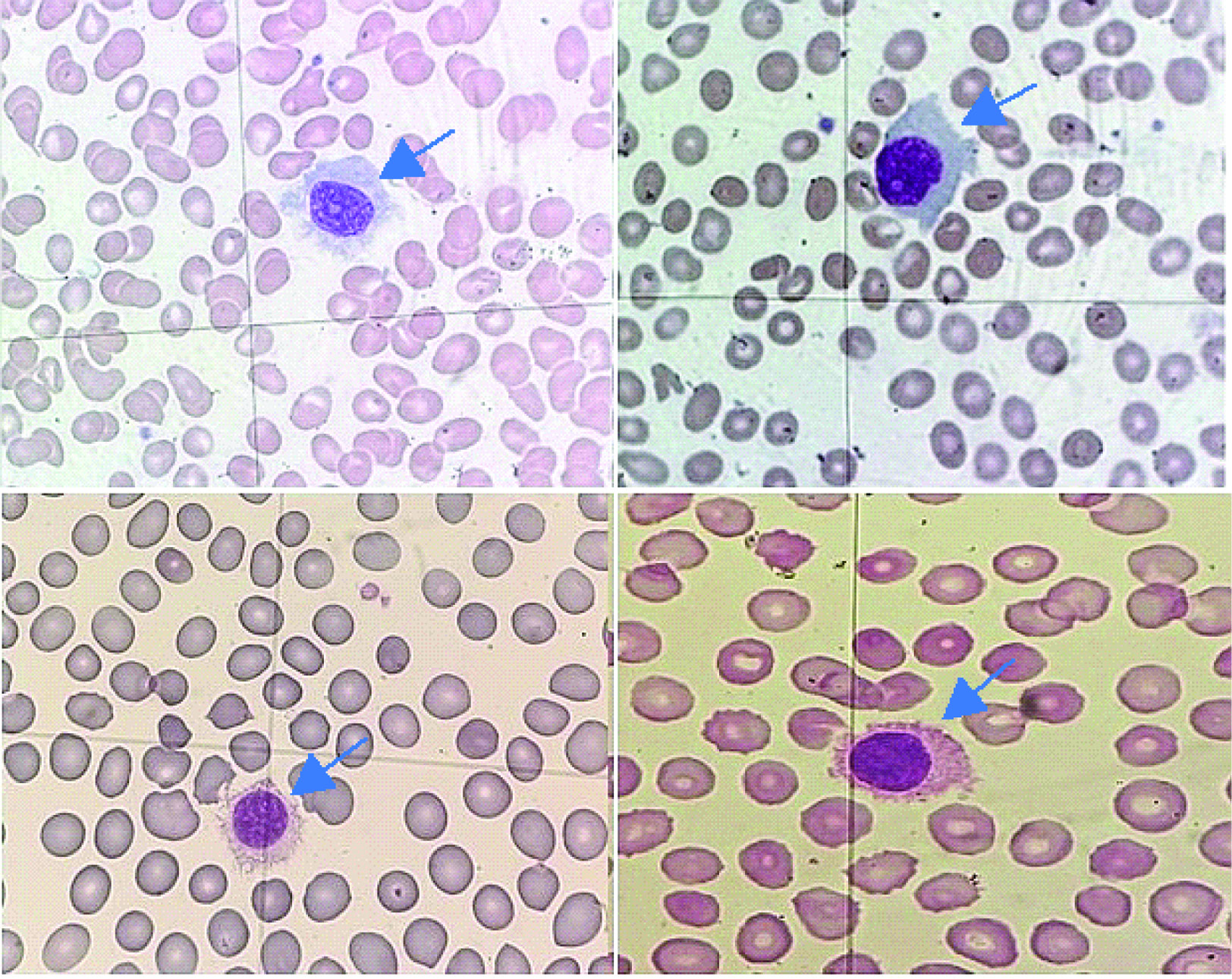 https://www.biochemia-medica.com/assets/images/upload/xml_tif/bm-34-2-020502-f3.png