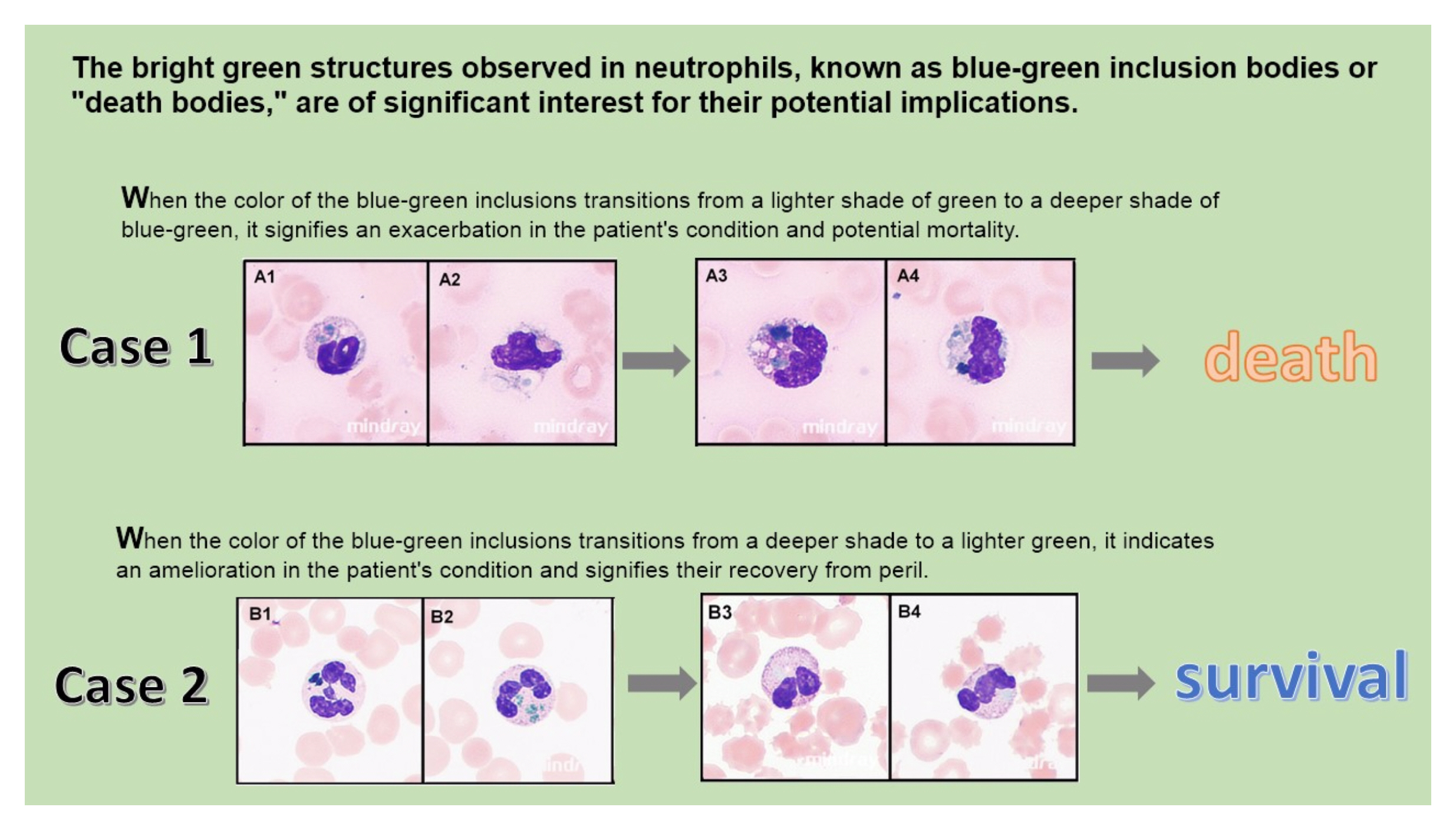 https://www.biochemia-medica.com/assets/images/upload/xml_tif/bm-34-3-030801-g1.png